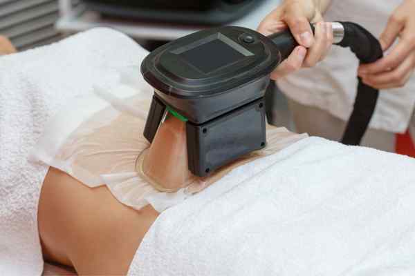 Areas of the Body we treat Cryolipolysis Willenhall