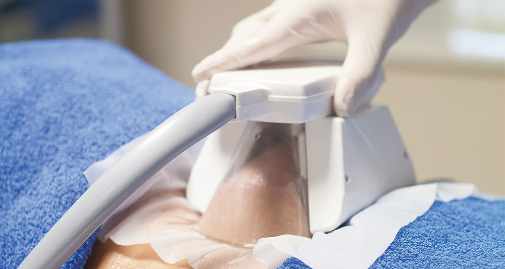 How Fat Freezing and HIFU Work Together? 2 Multiple Areas in One Session HIFU and Fat Freezing Willenhall