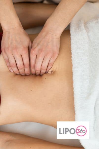 diastasis recti treatment Willenhall