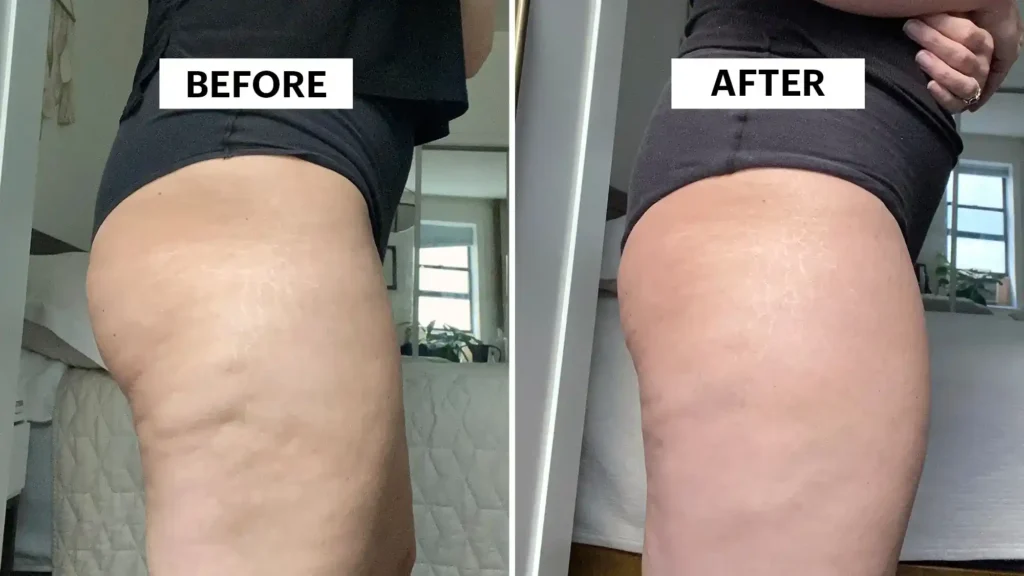 Do Toning Exercise Willenhall Really Tackle Cellulite?