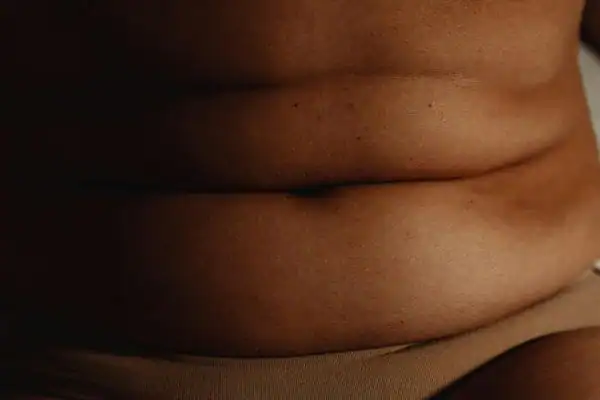 The Hidden Connection: How Stress Shapes Your Fitness and Body Composition 3 image of what stress can do on the stomach area and how Lipo 360 Willenhall can help to change your body shape.